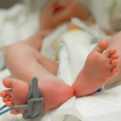 A new-born baby with his foot attached to a medical monitoring device illustrating our story on a compensation claim in a case involving a baby born with cerebral palsy as well as our look at neonatal hypoglycaemia