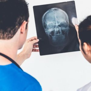 TBI at work claims