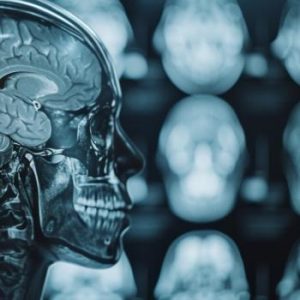 Paediatric Brain Injury