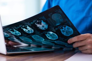 Radiologist holding a brain scan