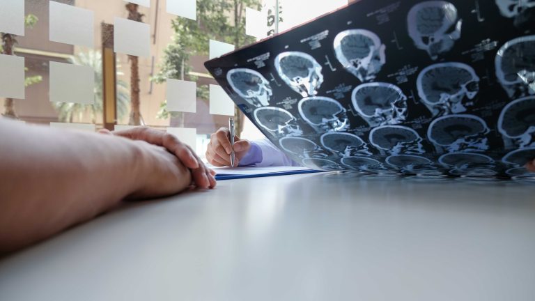 Imaging that may be used to help diagnose a brain injury