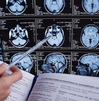 traumatic brain injury